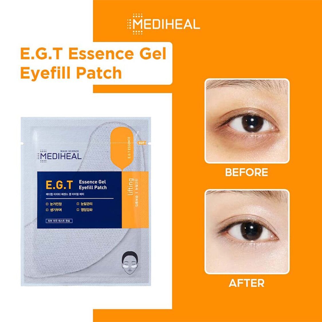 Mediheal E.G.T Essence Gel Eyefill Patch 5pcs 155073
