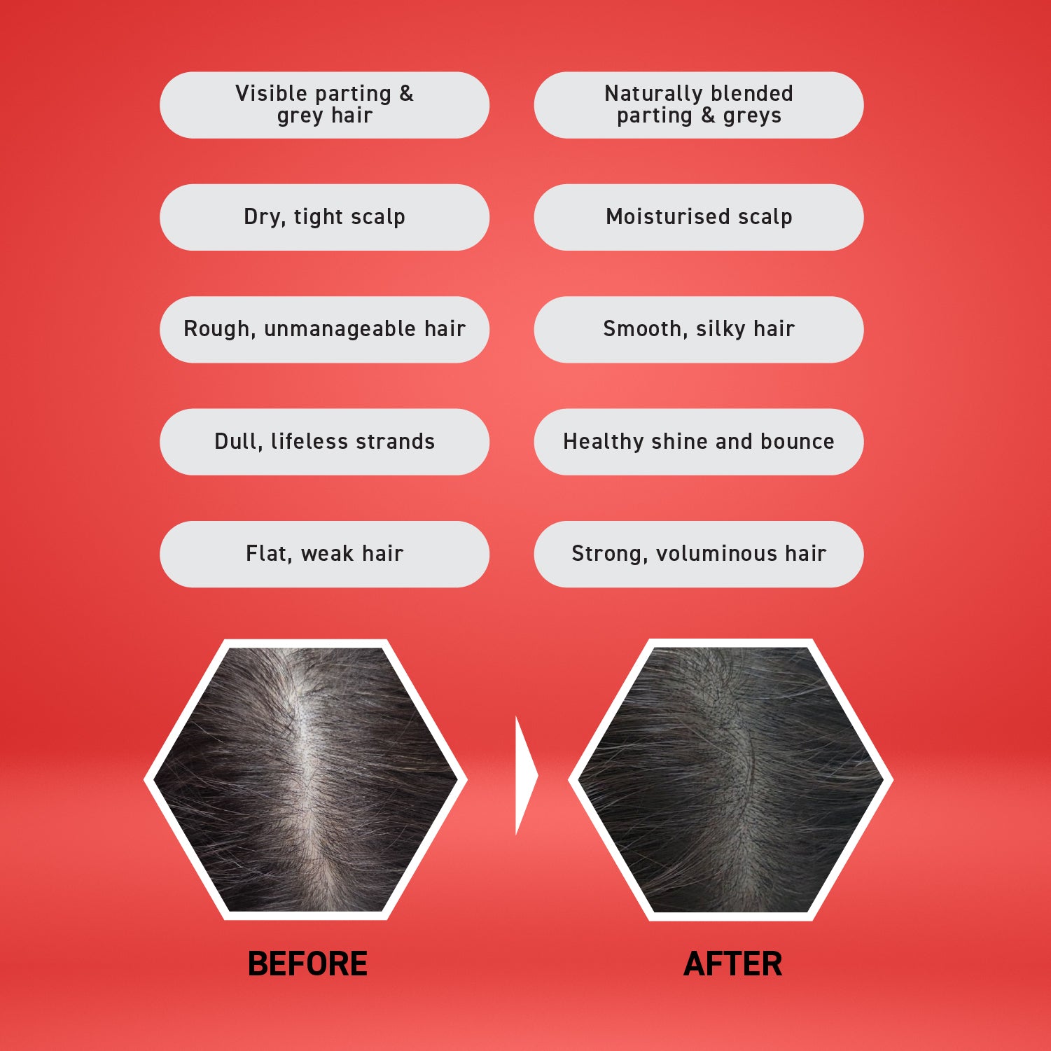 Fusari Medicated Hair Growth Essence