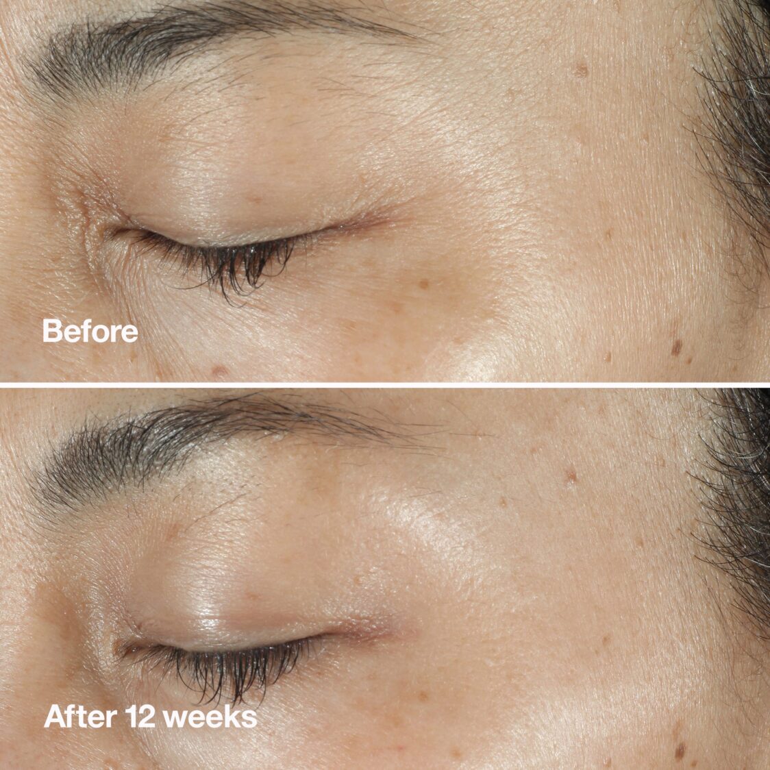 Clinique Smart Clinical Repair™ Wrinkle Correcting Serum - Metro Singapore Departmental Store - Celebrating 69 Years in SG