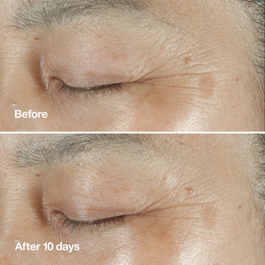Clinique Smart Clinical Repair™ Wrinkle Correcting Serum - Metro Singapore Departmental Store - Celebrating 69 Years in SG