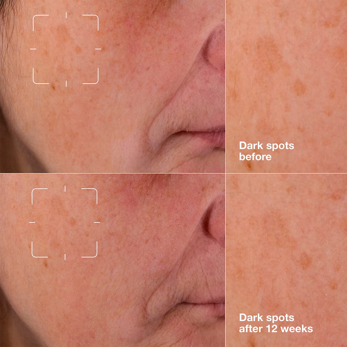 Clinique Even Better Clinical™ Dark Spot Clearing Serum - Metro Singapore Departmental Store - Celebrating 69 Years in SG