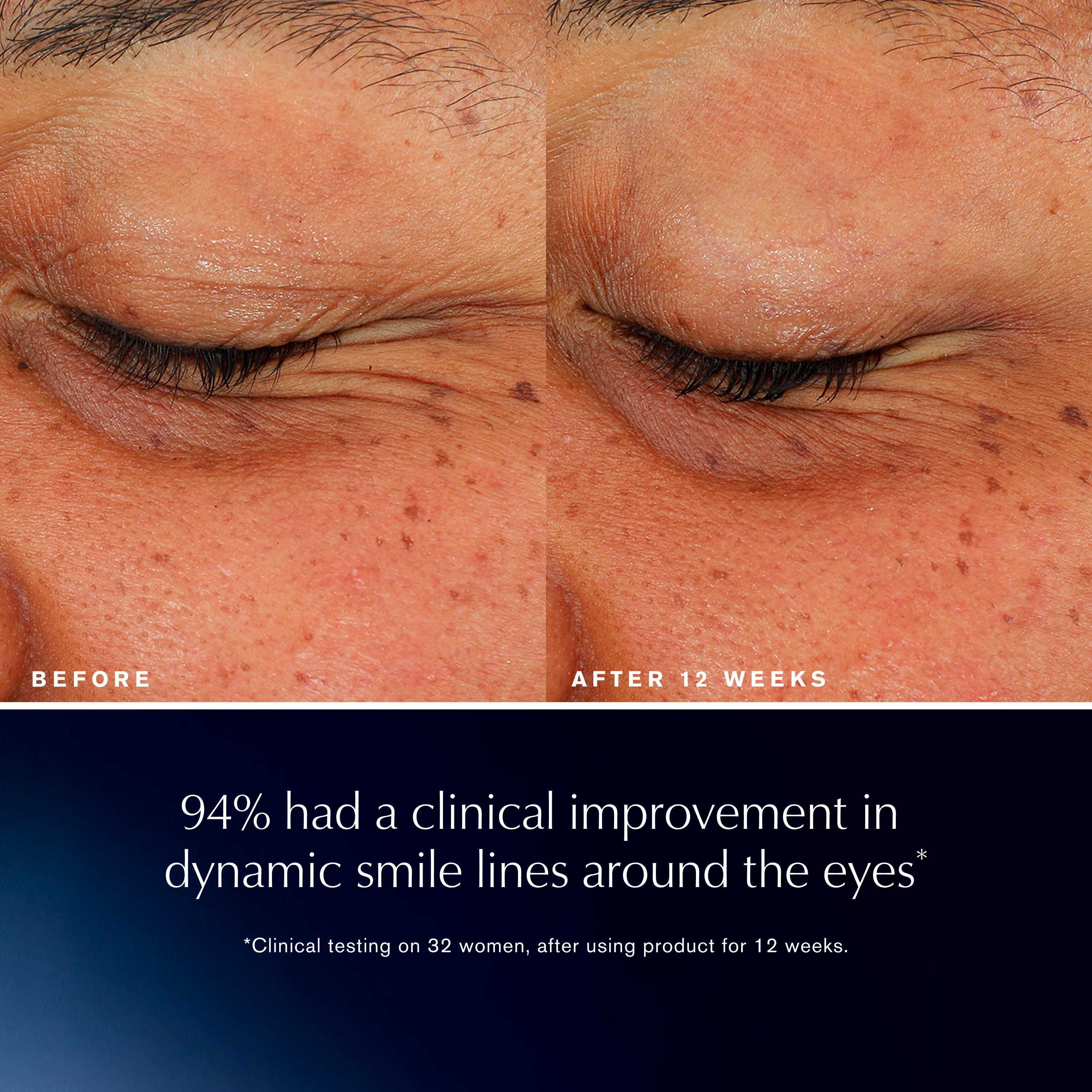 Estée Lauder Advanced Night Repair Eye Lift + Sculpt Eye Cream 15ml