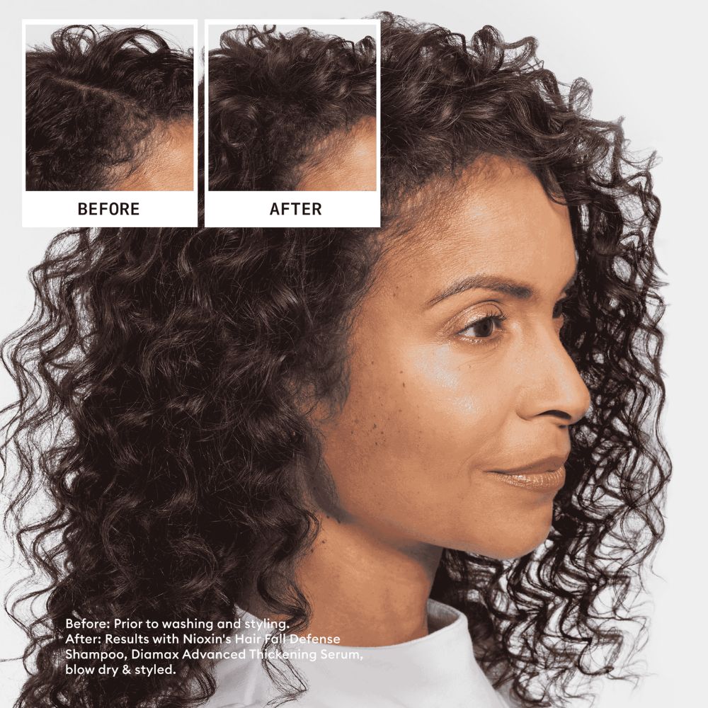 Nioxin Anti-Hair Loss Shampoo 240ml - Metro Singapore Departmental Store - Celebrating 69 Years in SG